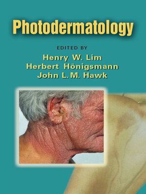 cover image of Photodermatology